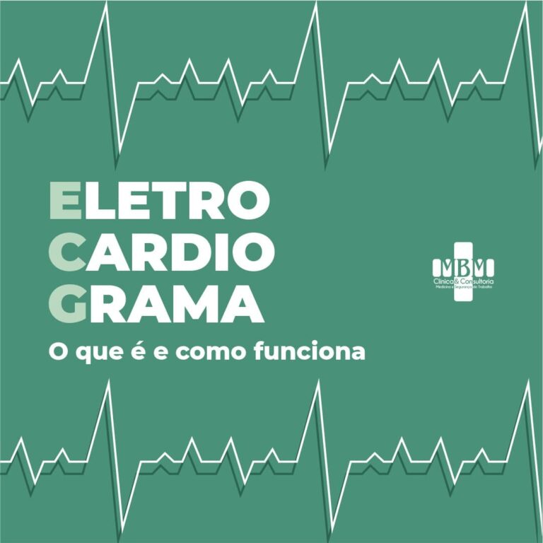 Eletrocardiograma